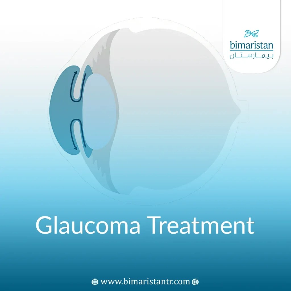 Glaucoma Surgery In Turkey