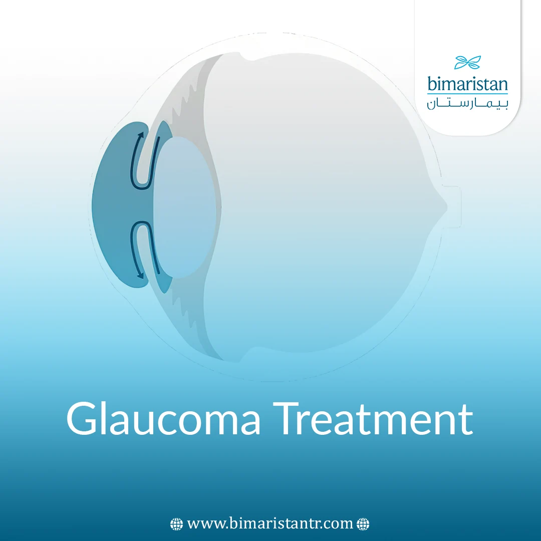 Glaucoma Surgery In Turkey