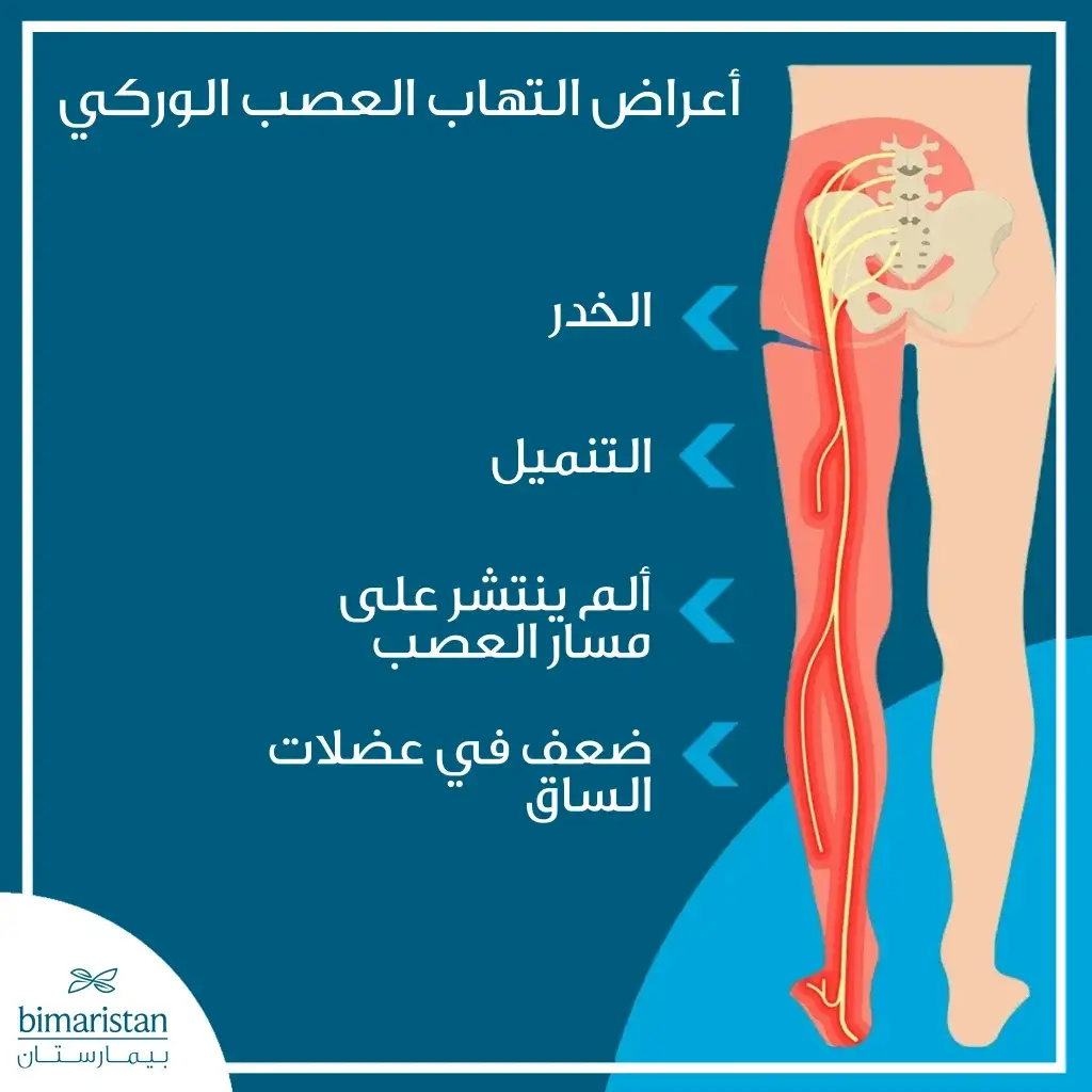 تشمل اعراض التهاب الصعب الوركي الخدر والتنميل والألم وضعف العضلات