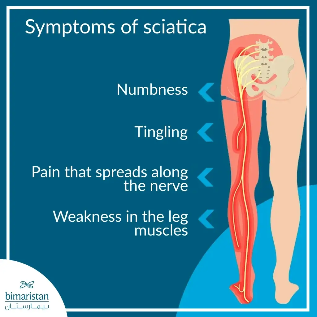 Symptoms Of Sciatica Include Numbness, Tingling, Pain, And Muscle Weakness.