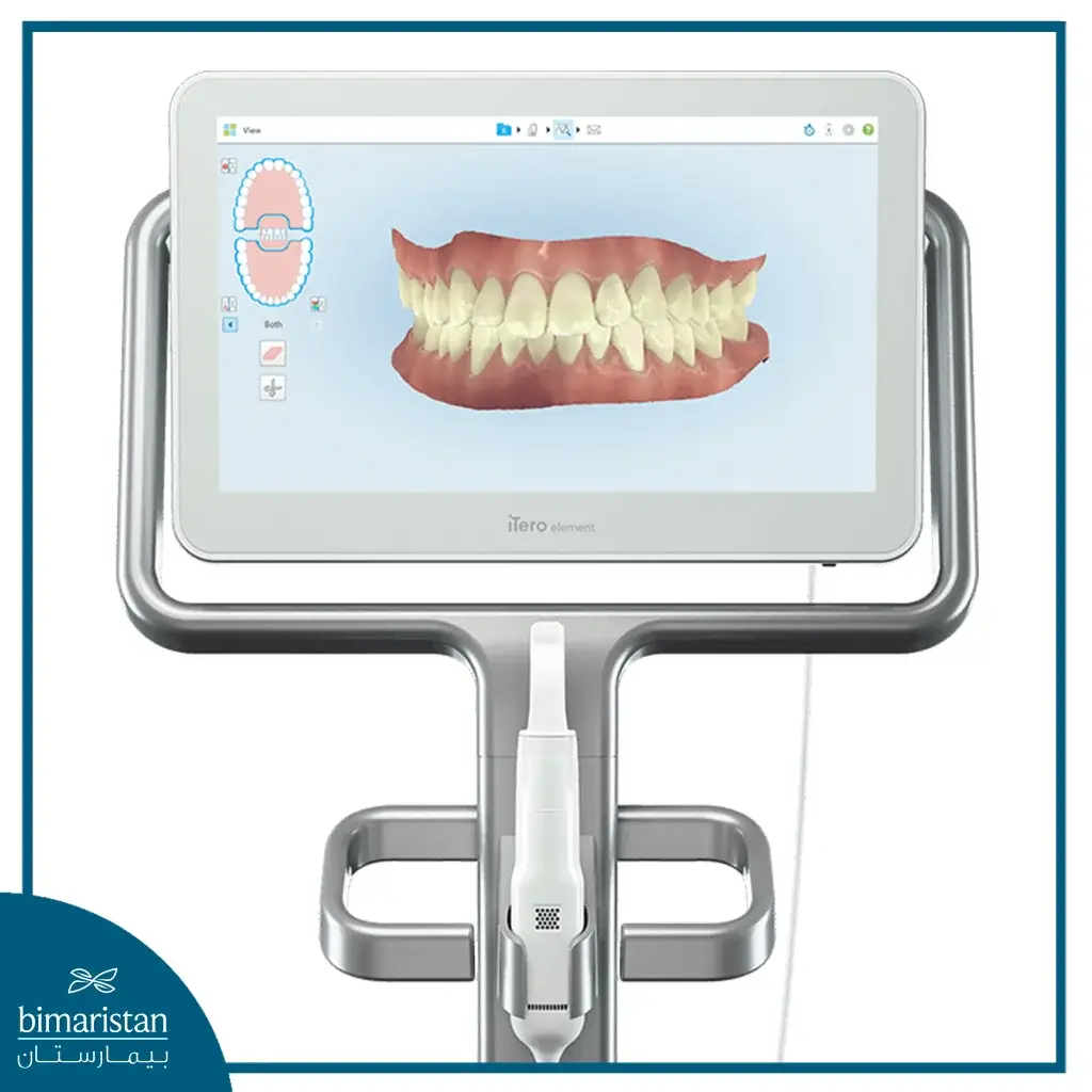 Intraoral Scanner In Turkey Is An Alternative To The Annoying Traditional Impression Materials In Dental Clinics