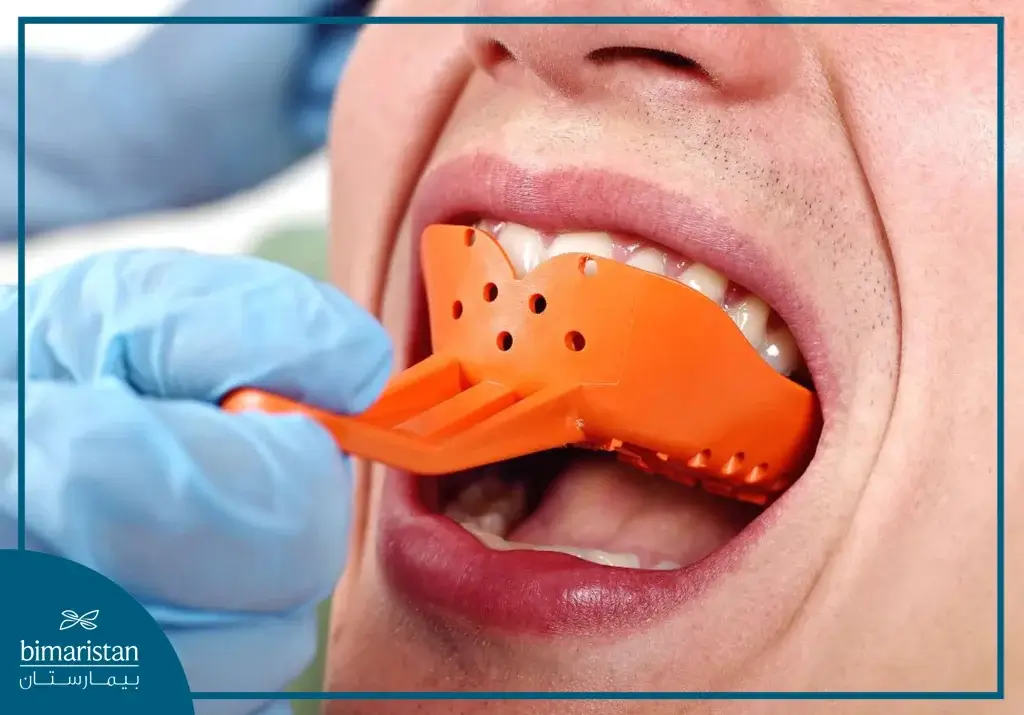 Traditional Dental Impressions Are Annoying To Patients.