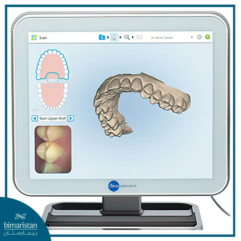 Digital Dental Impressions Are More Accurate In Intraoral Scanner.