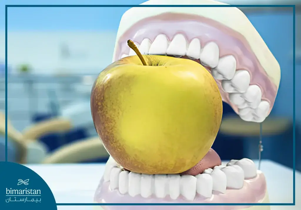 Surgical Orthodontics In Istanbul