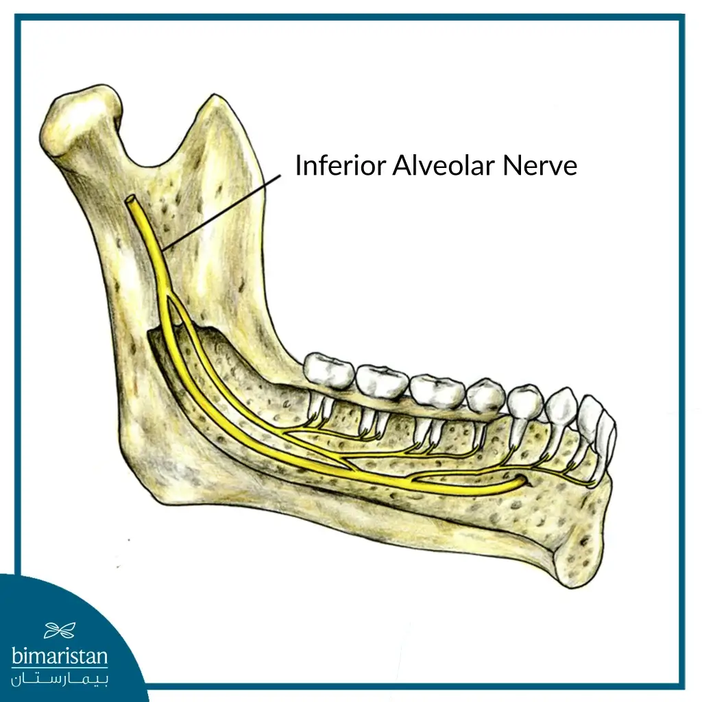 Inferior Alveolar Nerve