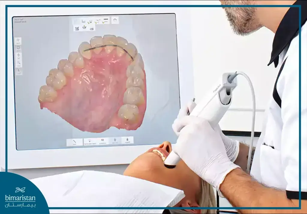 التصوير باستخدام تقنية الكاد كام Cerec Cad-Cam في اسطنبول