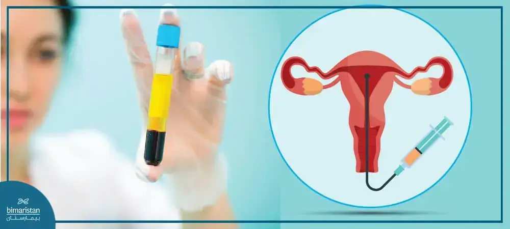 Benefits Of Plasma Injection Into The Uterus In Turkey