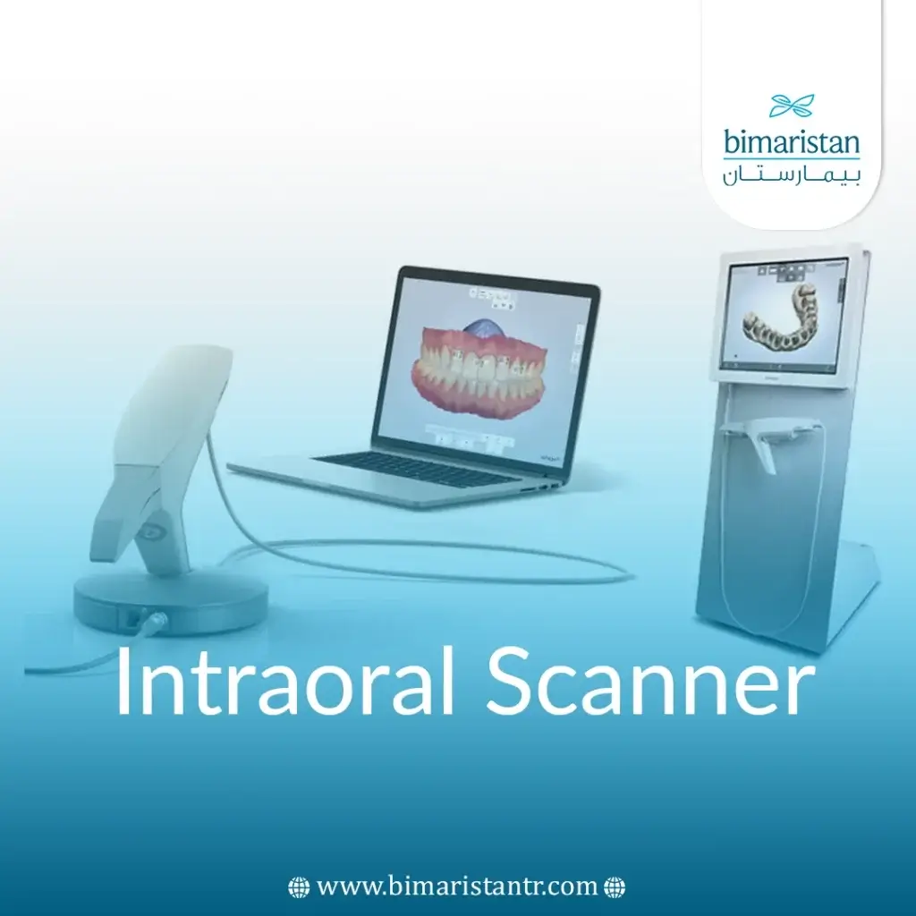 Intraoral Scanner For 3D Digital Prints