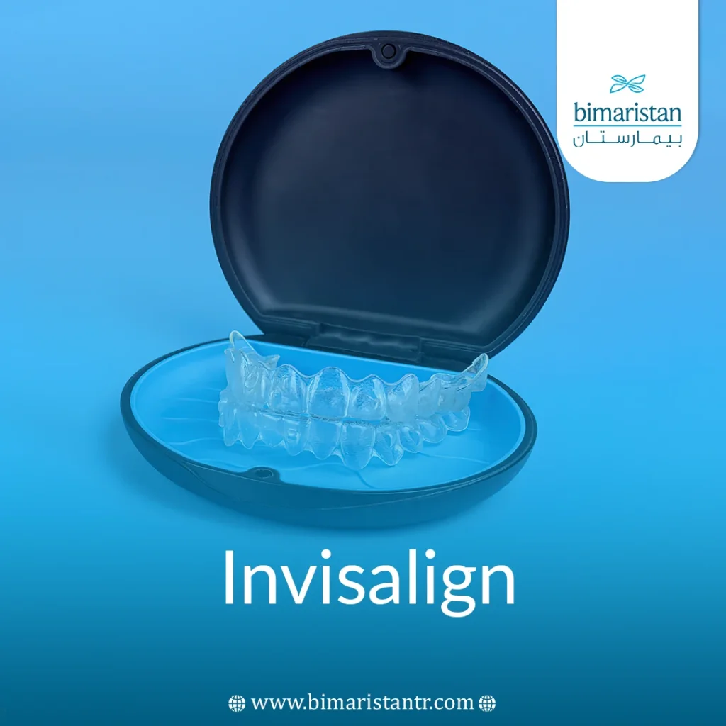 Invisalign: Clear Removable Aligners