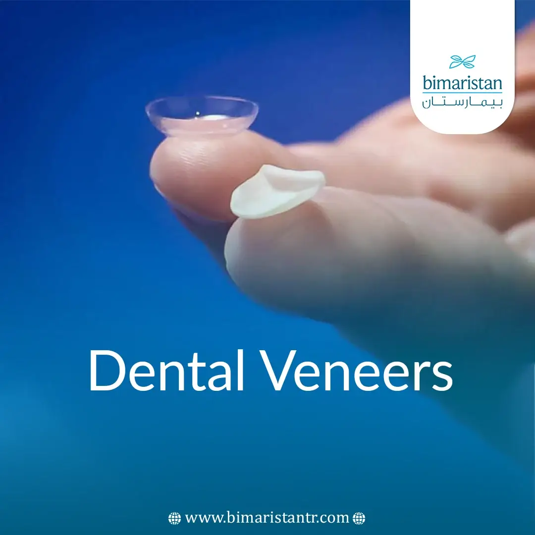 Dental Veneers Installation In Turkey