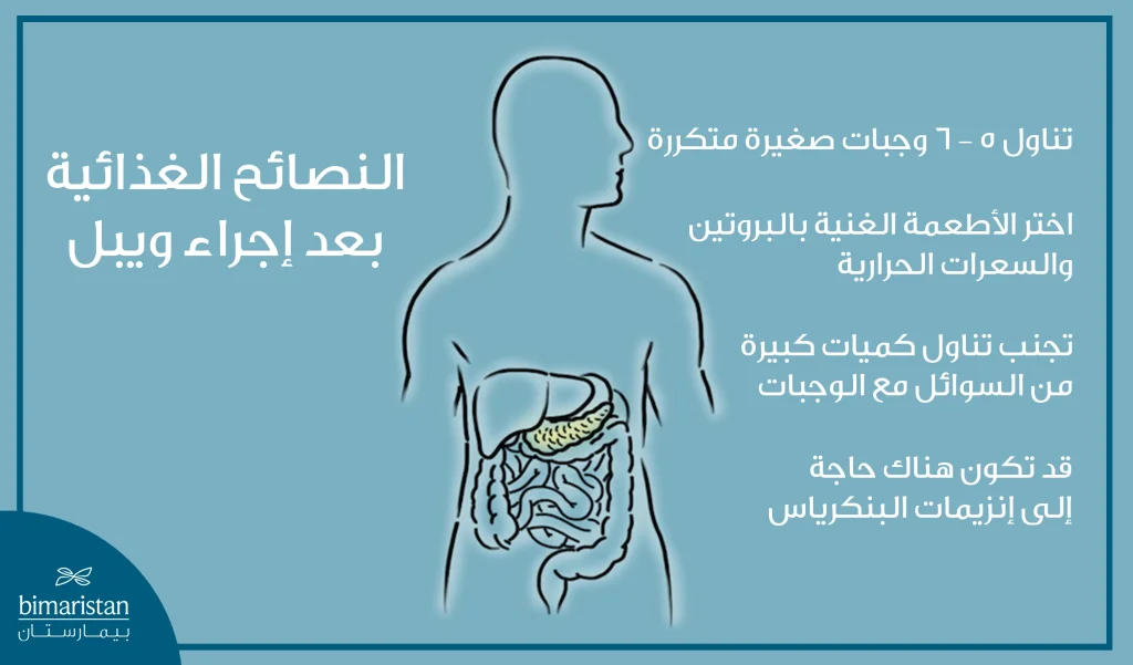 بعد اجراء ويبل يجب على المريض تناول وجبات صغيرة غنية بالبروتين والسعرات بشكل متكرر وتجنب الإكثار من السوائل مع الوجبات