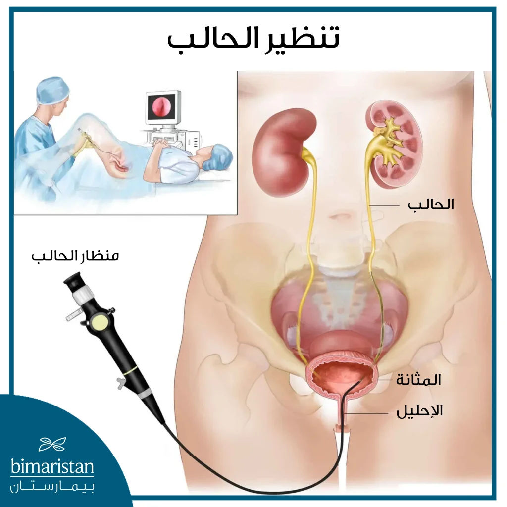 تنظير الحالب باستخدام المنظار المرن وذلك لنفي وجود مشاكل مرضية بالحالب