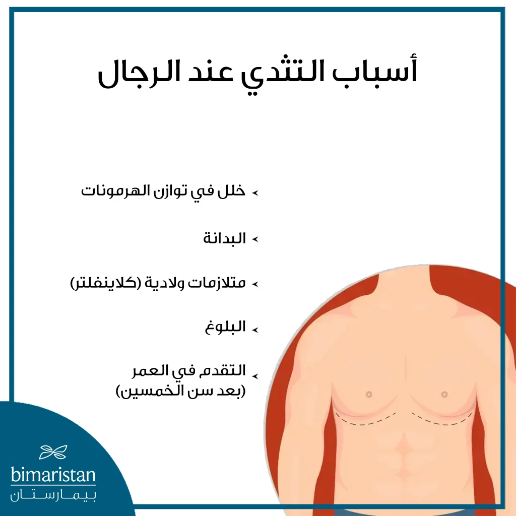 صورة لأشيع خمس أسباب للتثدي عند الرجال