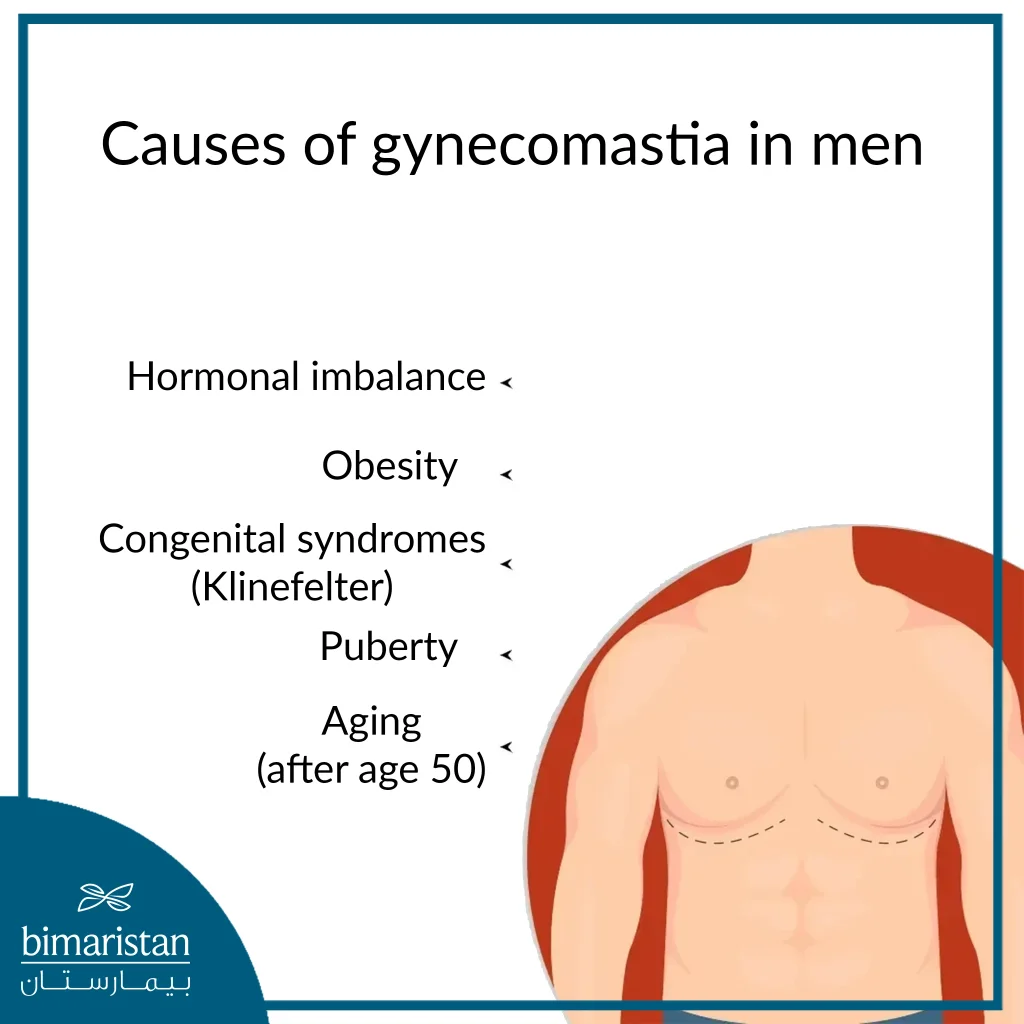 Image Of The Five Most Common Causes Of Gynecomastia In Men