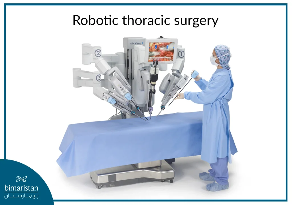 Robotic Lobectomy