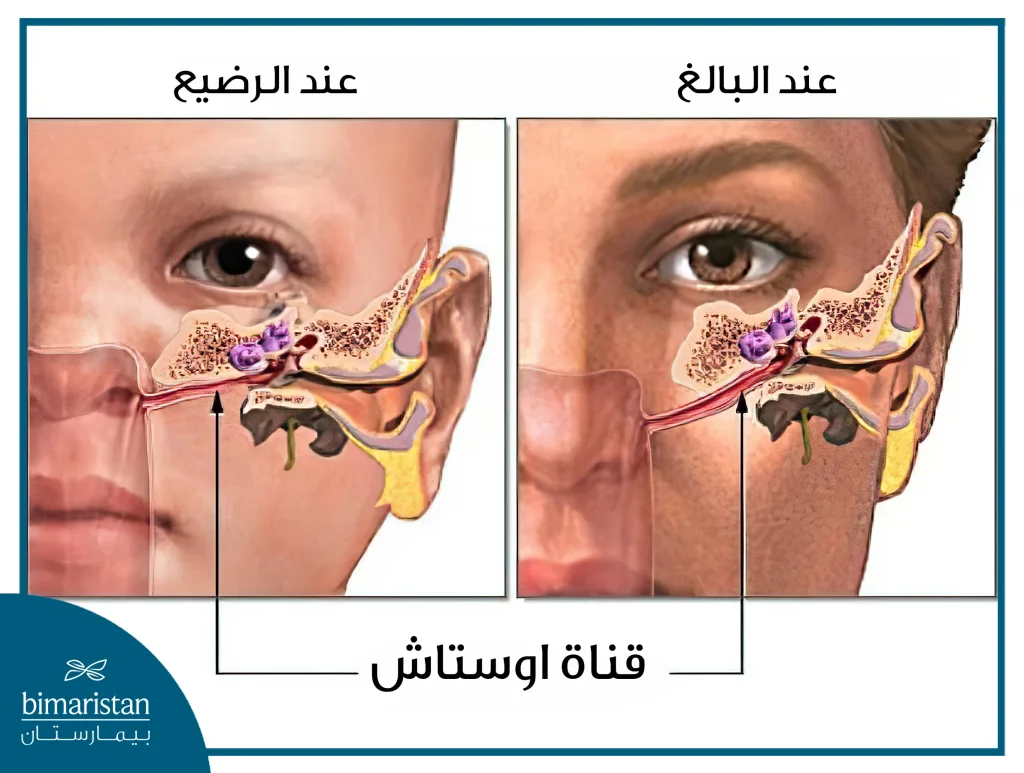 تكون قناة أوستاش أفقية أكثر عند الرضع