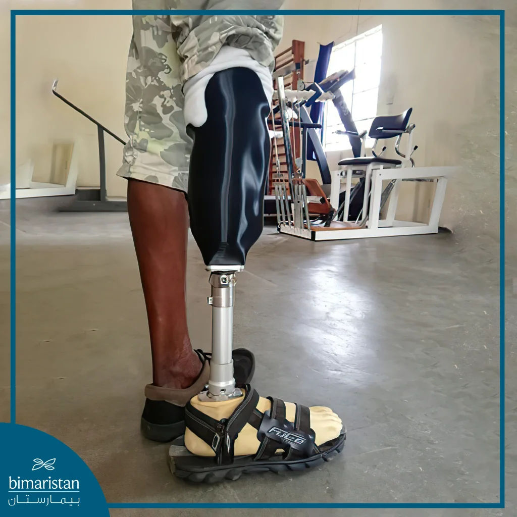 A Picture Showing A Lower Prosthetic Limb Used When Fitting Lower Prosthetic Limbs