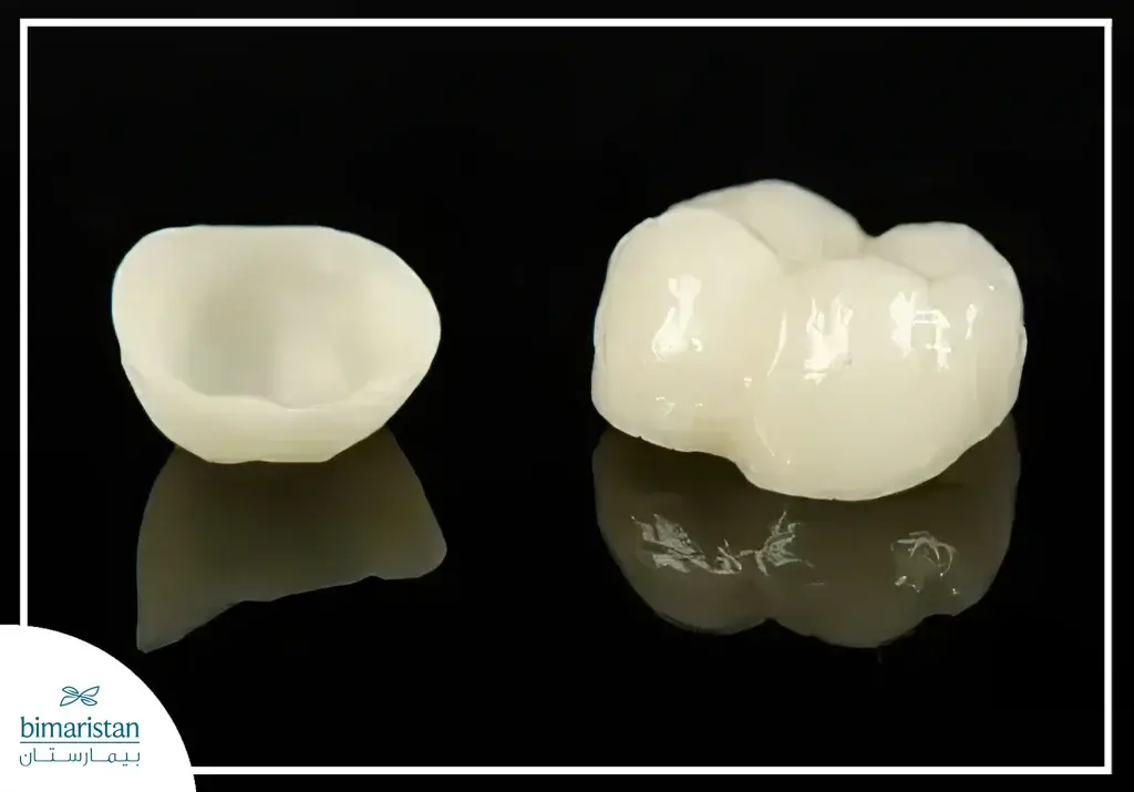 Ceramic Dental Crown