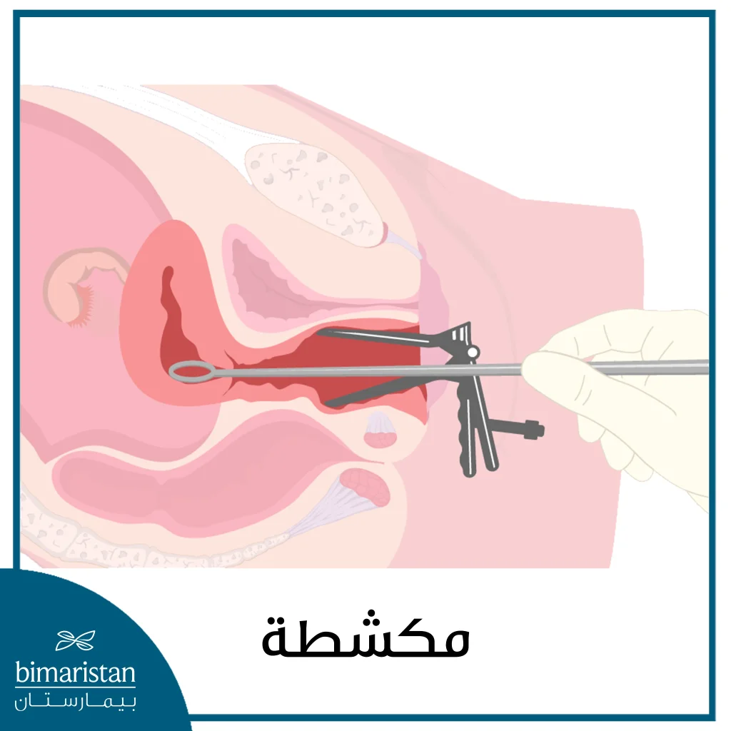 يتم توسيع وكحت الرحم باستعمال أداتين هما الموسع والمكشطة