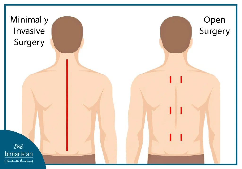 A Comparison Between Surgical Incisions In Traditional Surgery And Minimally Invasive Surgery.