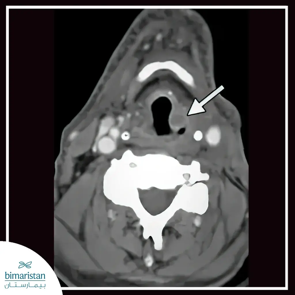 Ct Scan