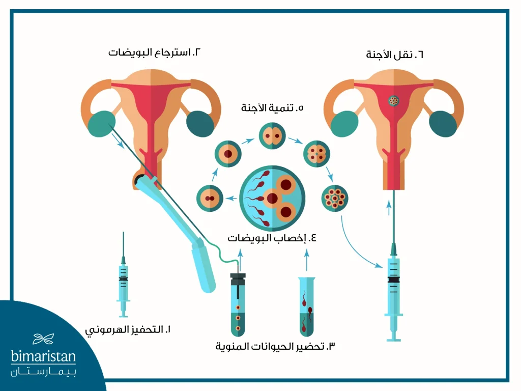 طريقة أطفال الأنابيب بالتفصيل - عملية أطفال الأنابيب بالصور