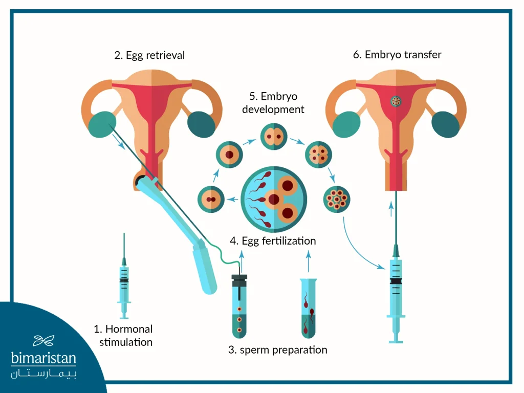 Ivf Method In Detail - Ivf Process With Pictures