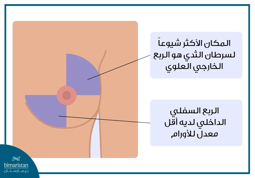 أين توجد كتلة سرطان الثدي بالصور