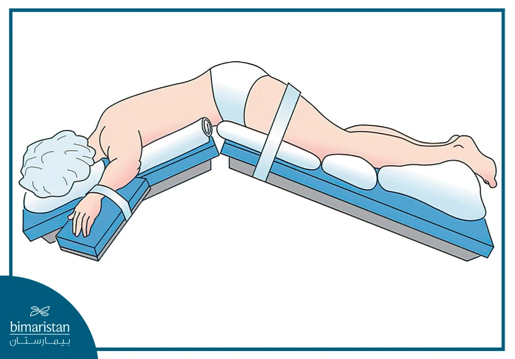 The Patient Lies In The Lithotomy Position For Laser Hemorrhoidoplasty