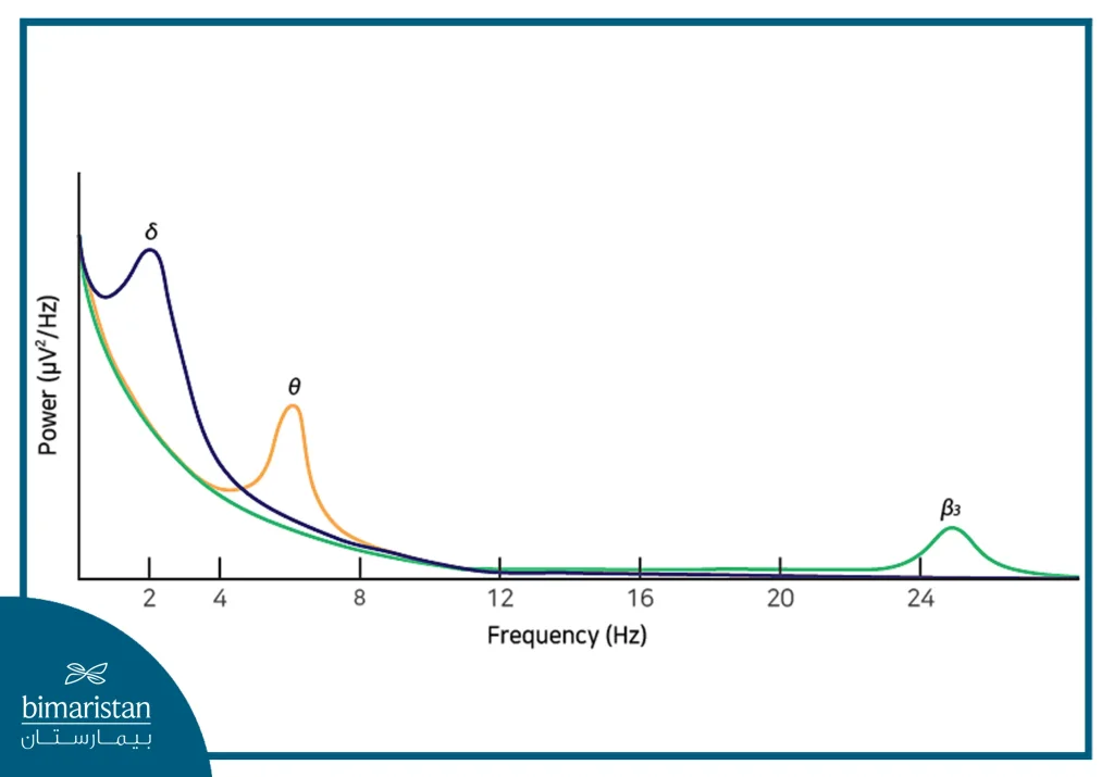 Qeeg Topographic Brain Mapping (Qeeg)