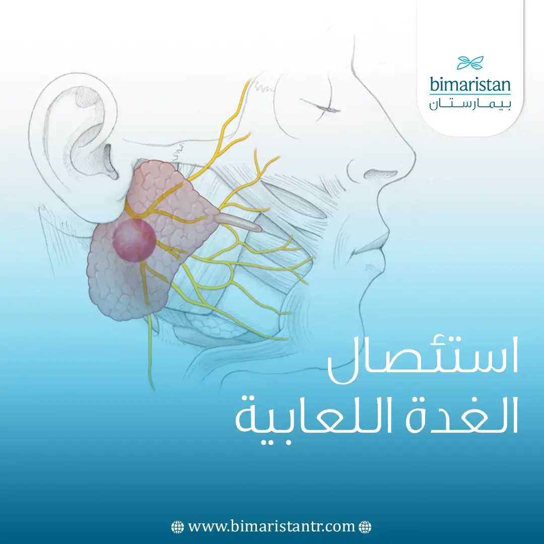 عملية استئصال الغدة اللعابية