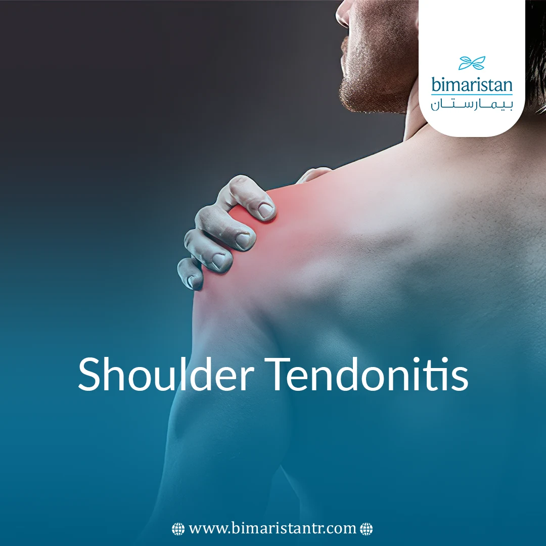 Shoulder Tendonitis