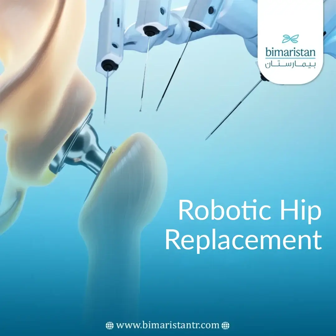 Robotic Hip Replacement Surgery