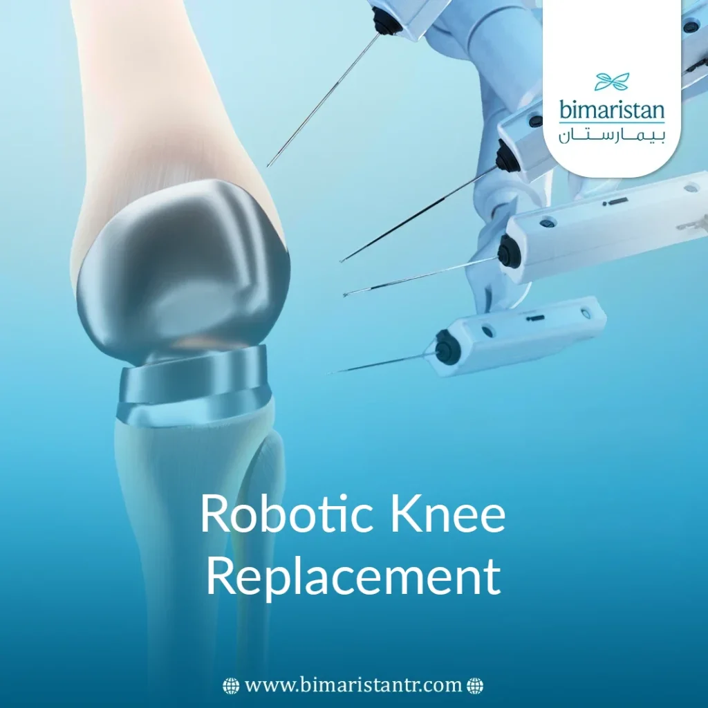 Robotic Knee Replacement