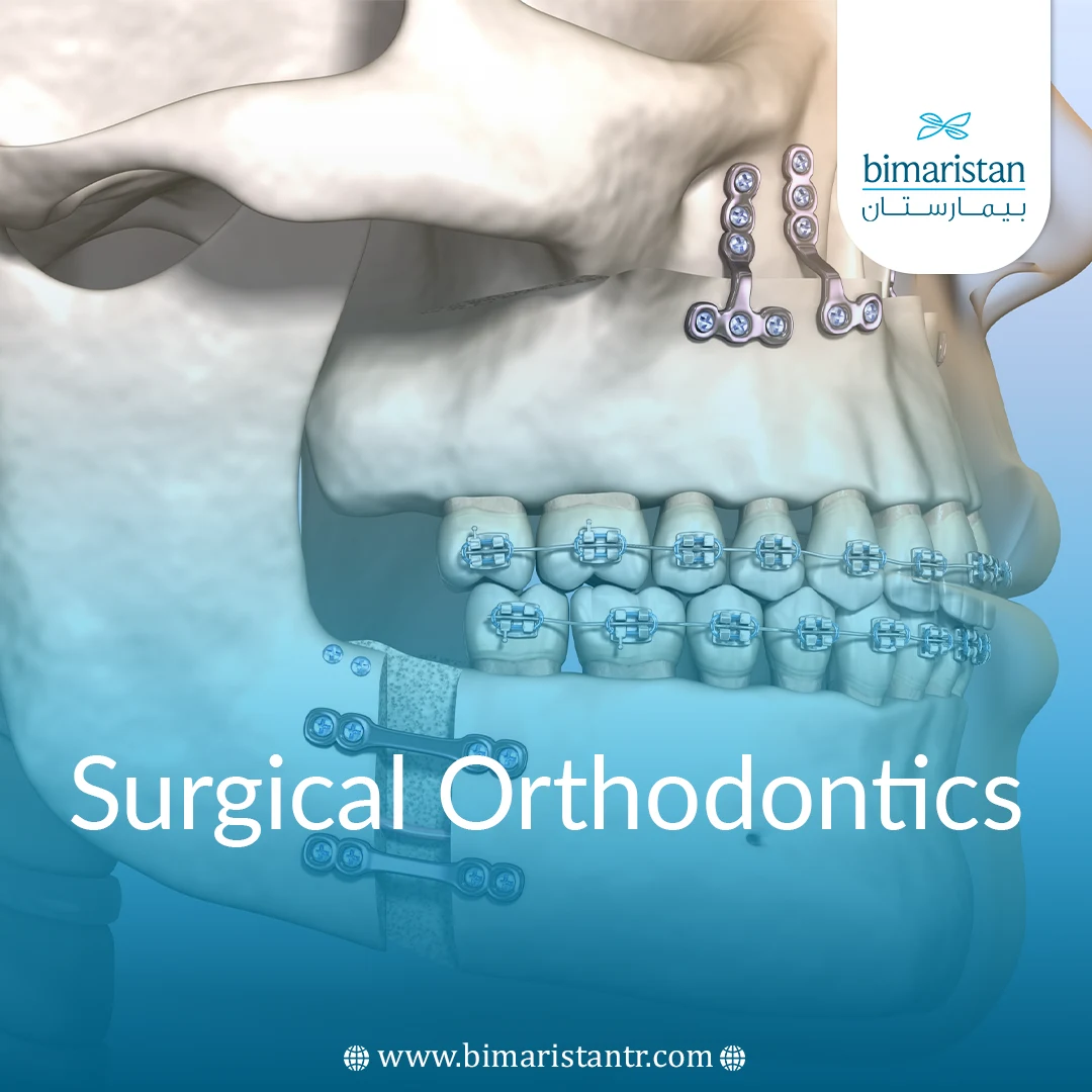 Surgical Orthodontics