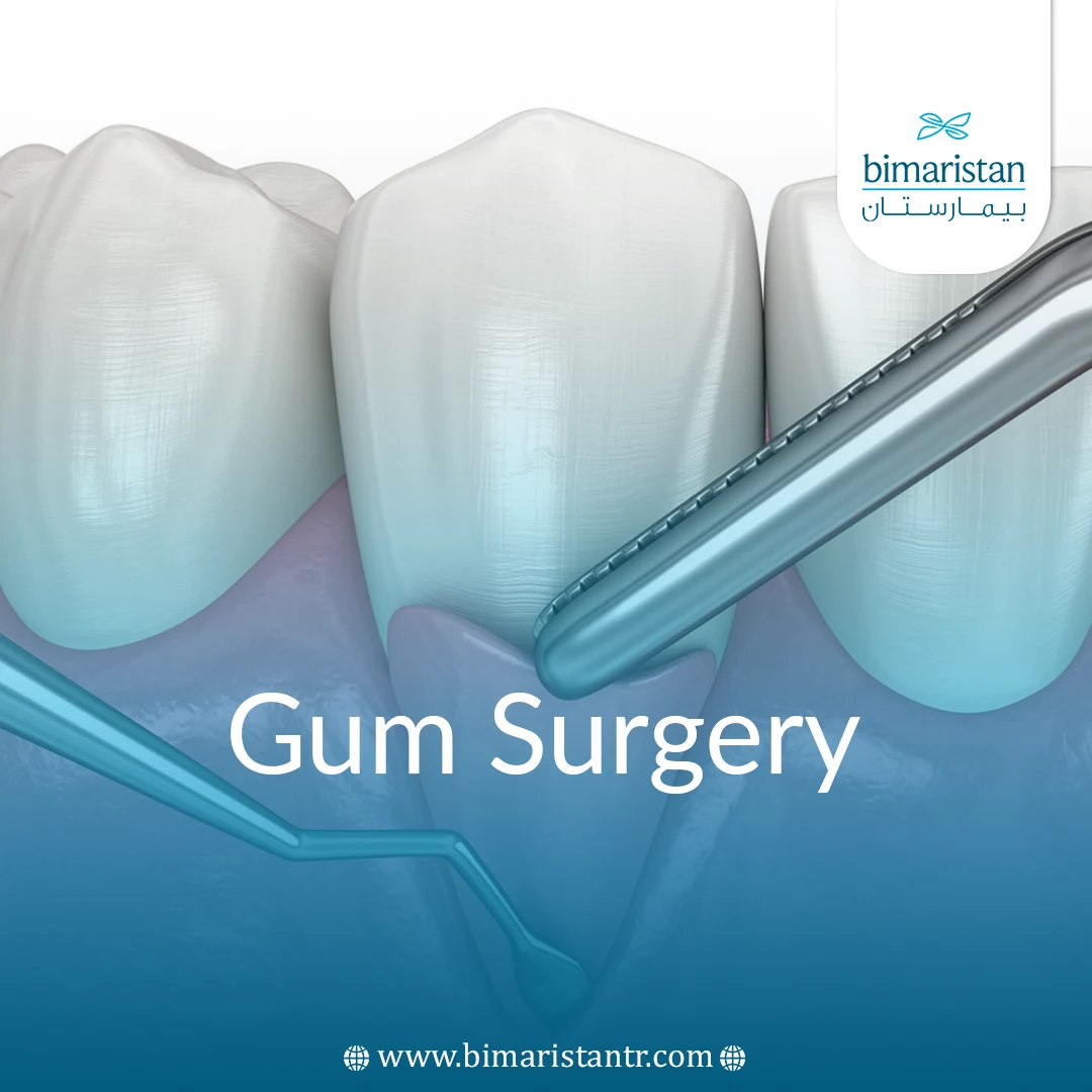 Gum Surgery In Turkey