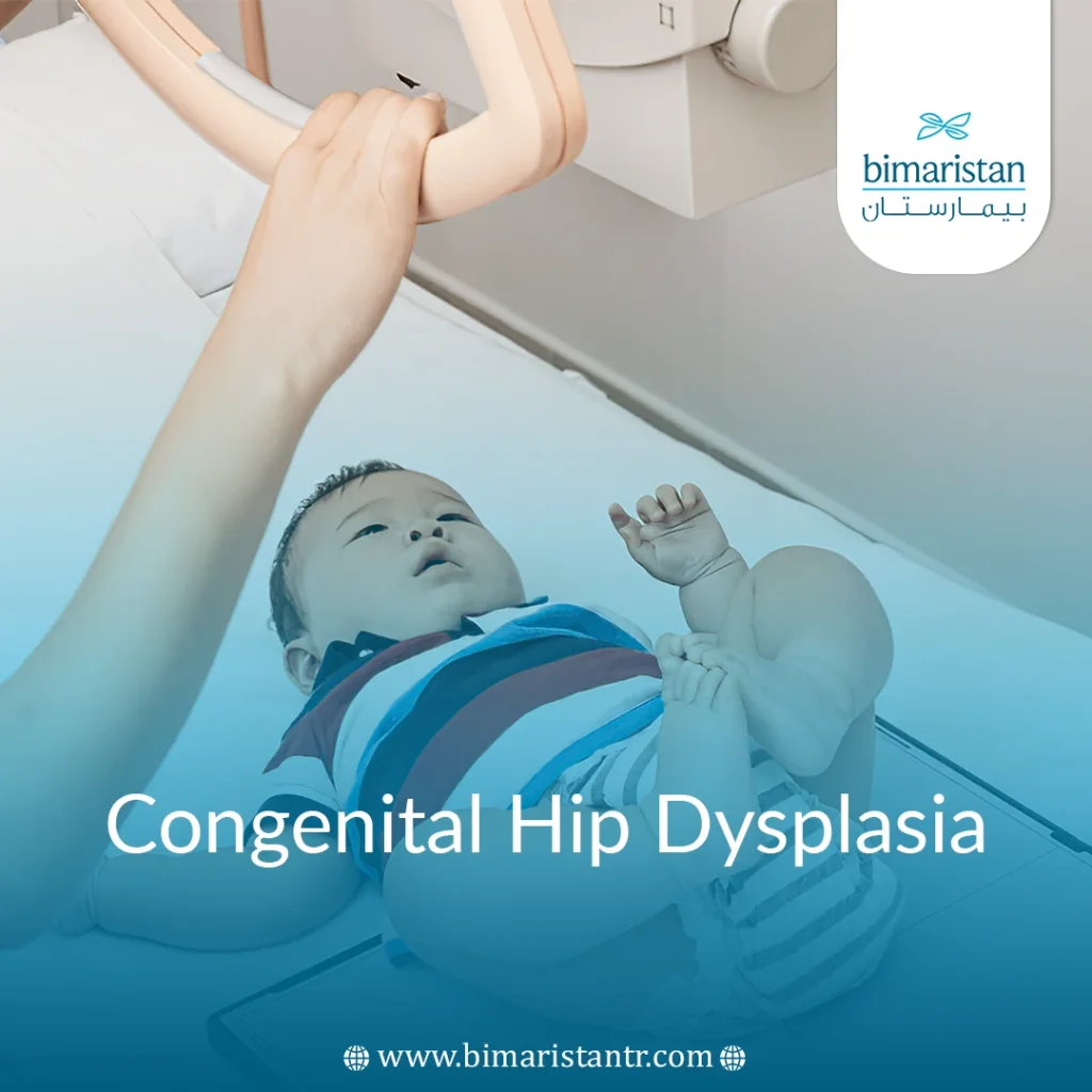 Congenital Hip Dysplasia