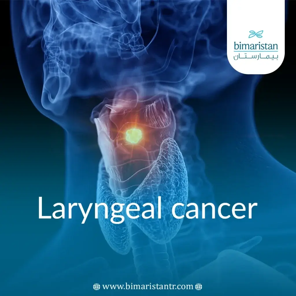 Treatment Of Laryngeal Cancer In Turkey