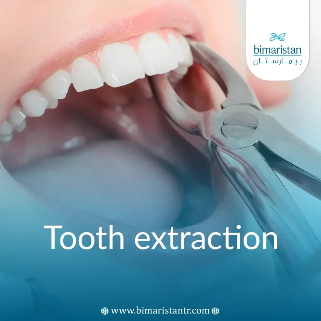 Tooth Extraction In Turkey