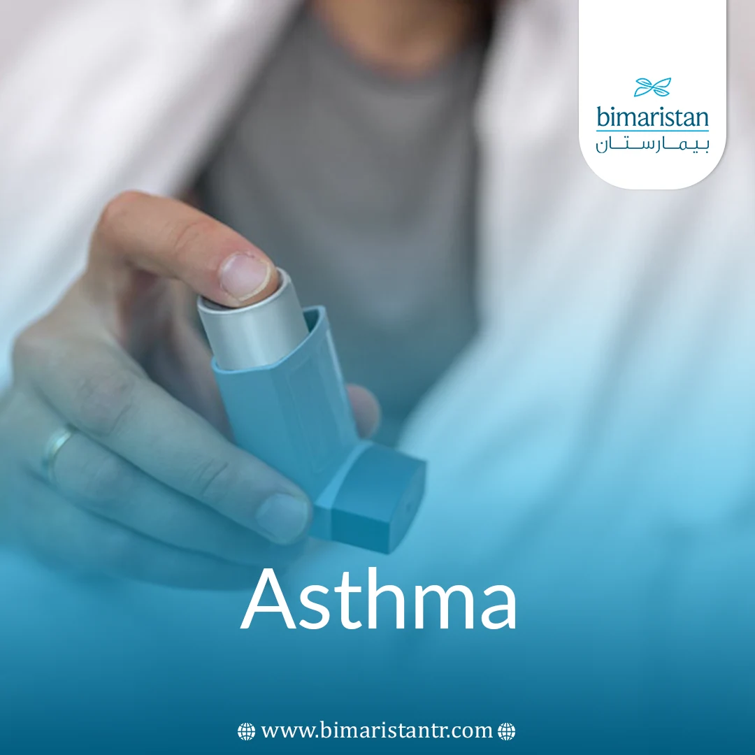 Bronchial Asthma Treatment