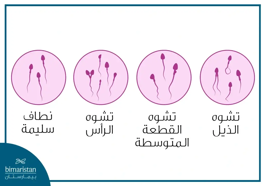 أنواع تشوهات الحيوانات المنوية