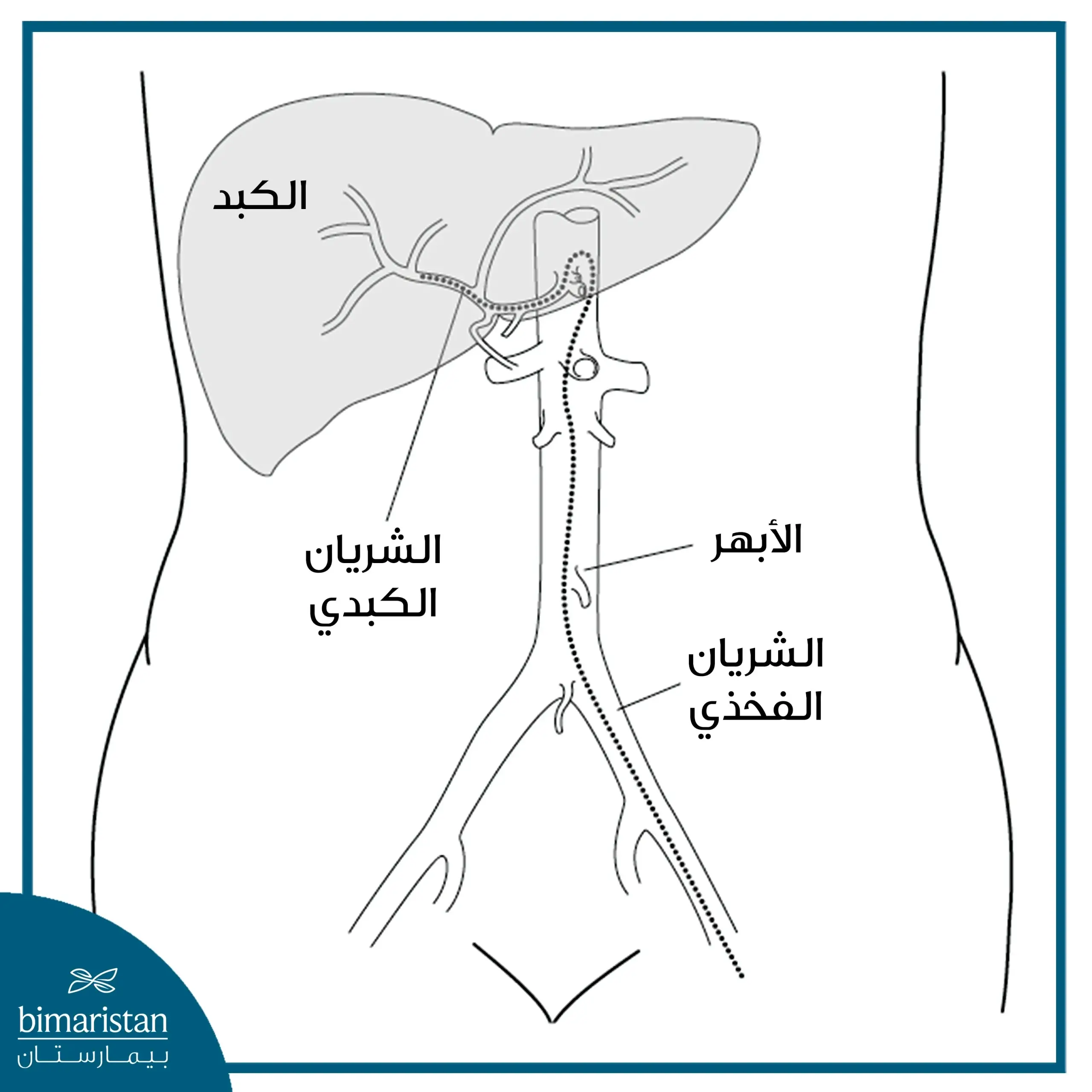 علاج الكتل السرطانية بالتخثير في الكبد