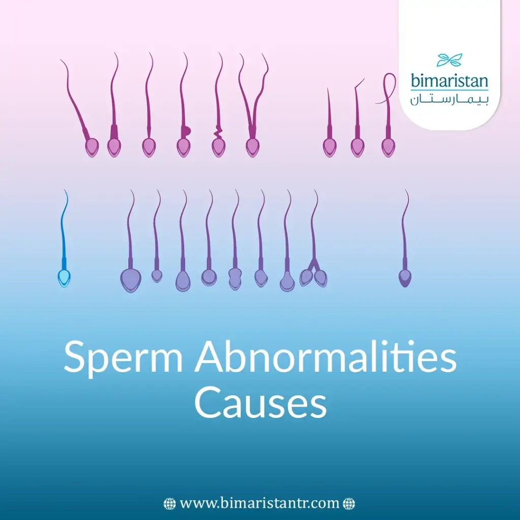 Sperm Abnormalities Causes