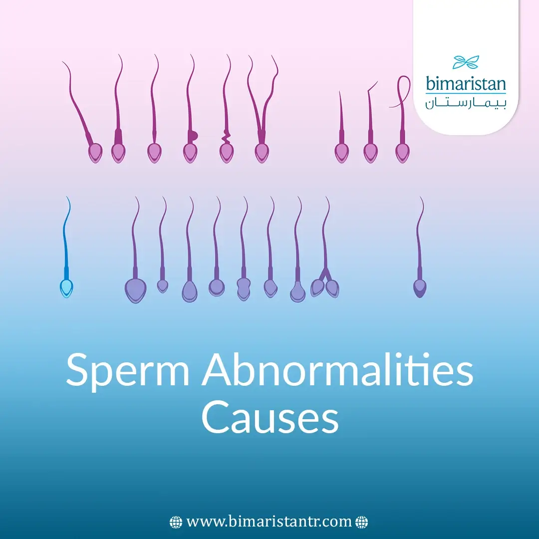 Sperm Abnormalities Causes