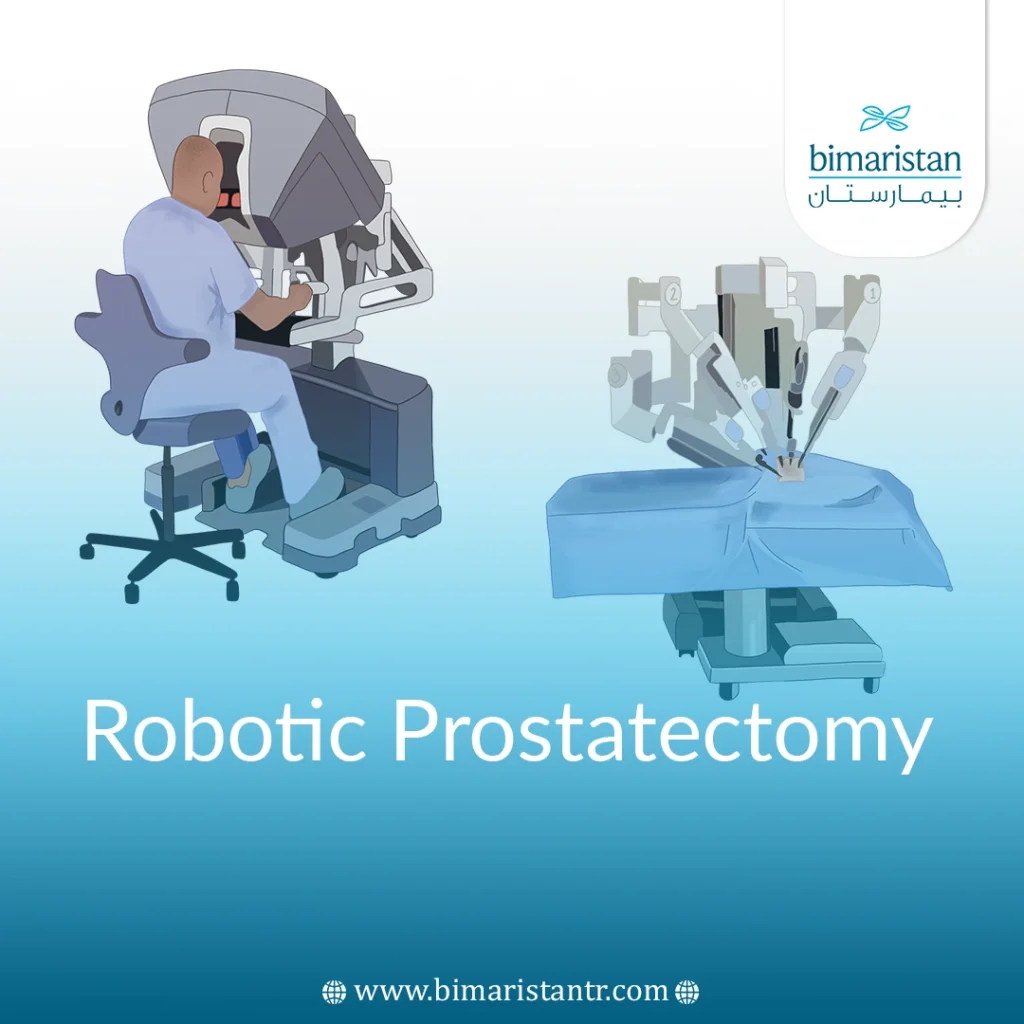 Robotic Prostatectomy in Turkey 2025 - Bimaristan