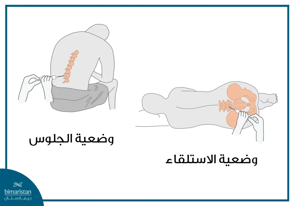 وضعيات البزل القطني ومكان دخول إبرة البزل