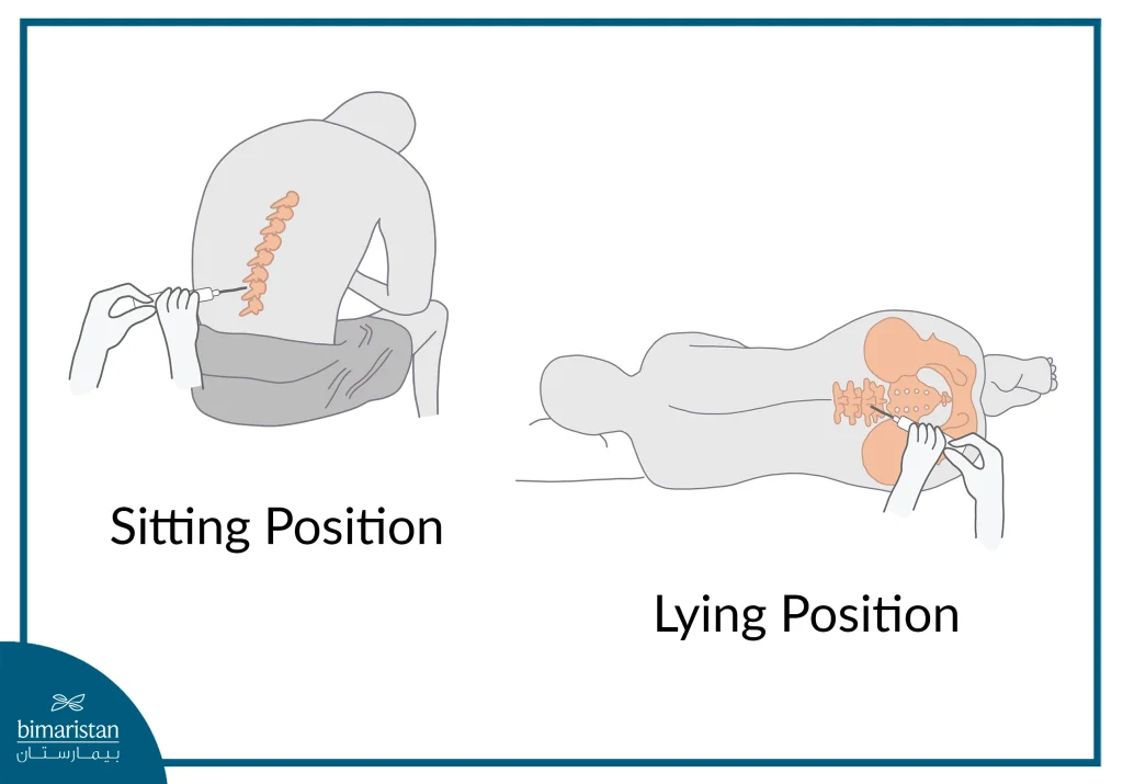 Lumbar Puncture Positions And Needle Insertion Location