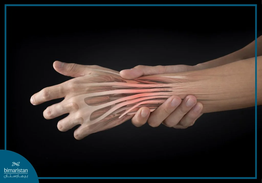 Hand Tendonitis