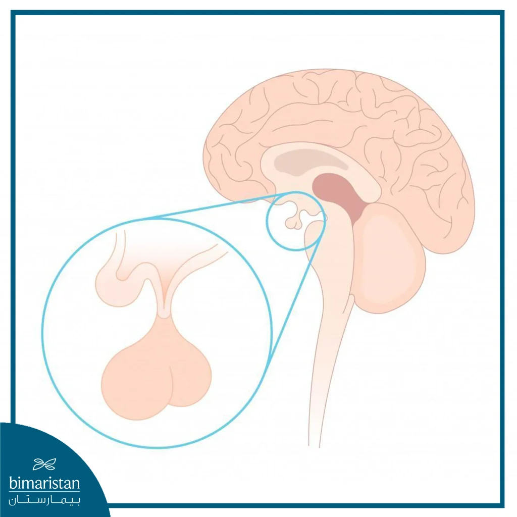 The Pituitary Gland Is Located At The Base Of The Brain In A Special Hole In The Sphenoid Bone Called The &Quot;Sella Turcica&Quot;