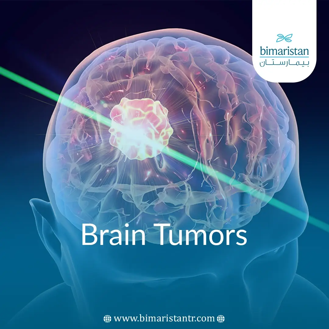 Brain Tumors Treatment